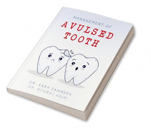 Management of Avulsed Tooth