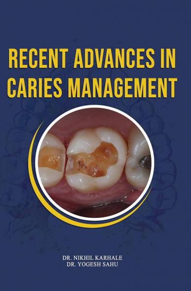 Recent Advances In Caries Management