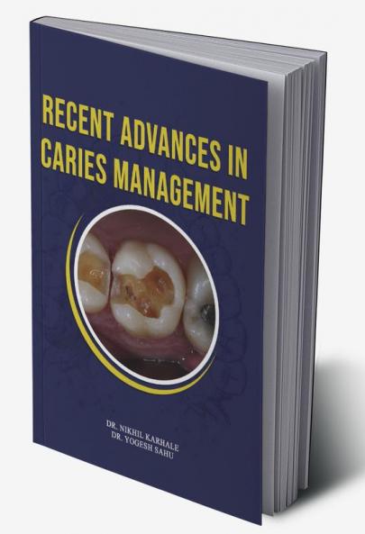 Recent Advances In Caries Management