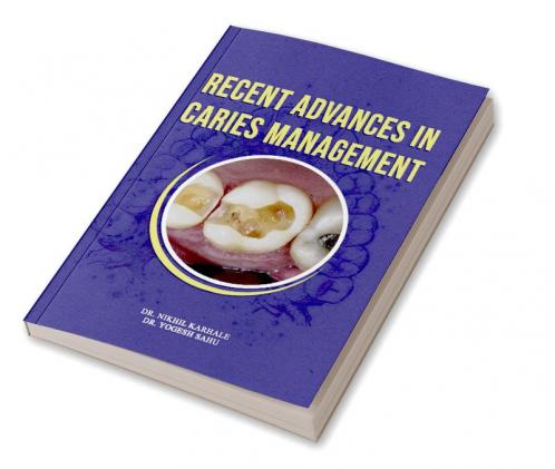 Recent Advances In Caries Management