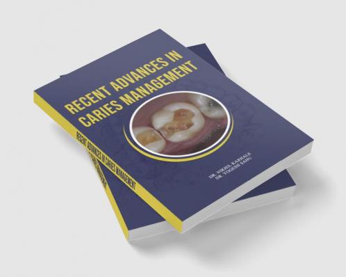 Recent Advances In Caries Management