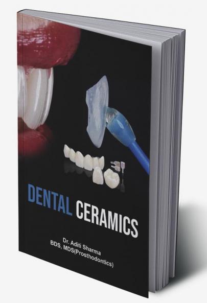 Dental Ceramics