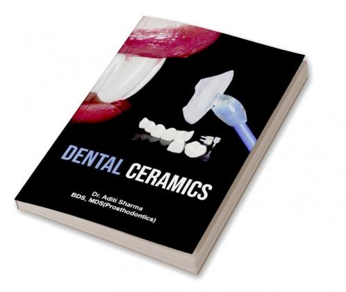 Dental Ceramics