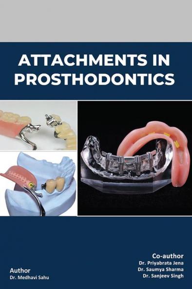 Attachments In Prosthodontics