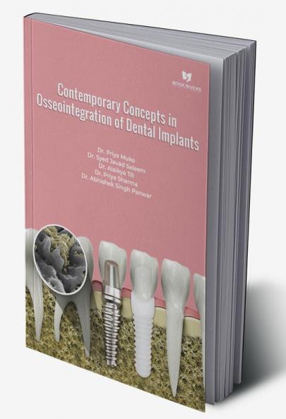 Contemporary Concepts In Osseointegration Of Dental Implants