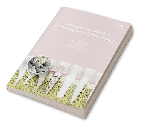 Contemporary Concepts In Osseointegration Of Dental Implants