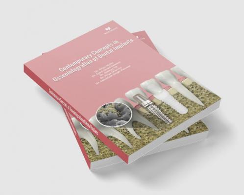 Contemporary Concepts In Osseointegration Of Dental Implants