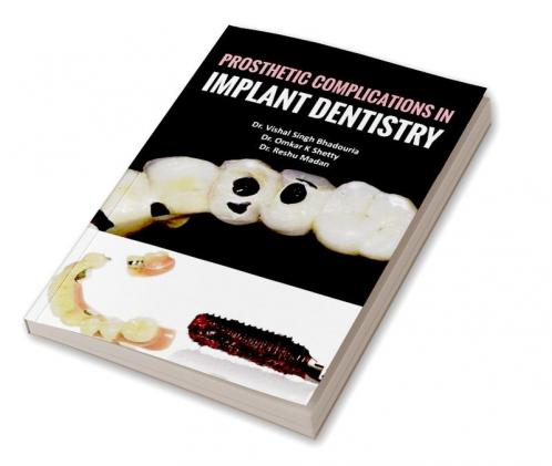 Prosthetic Complications In Implant Dentistry