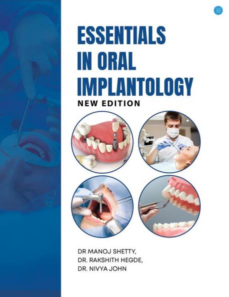 Essentials in Oral implantology