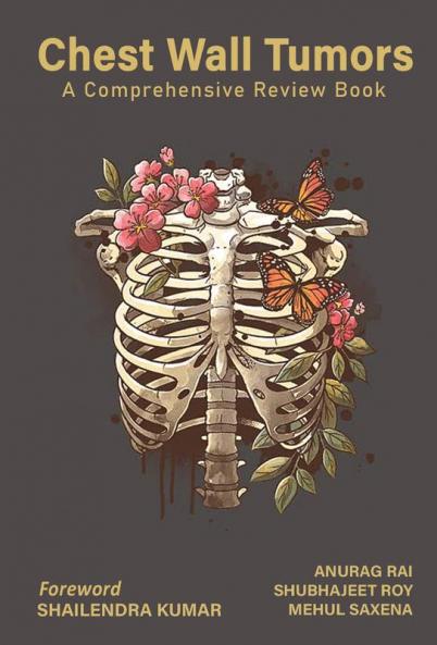 Chest Wall Tumors: A Comprehensive Review Book