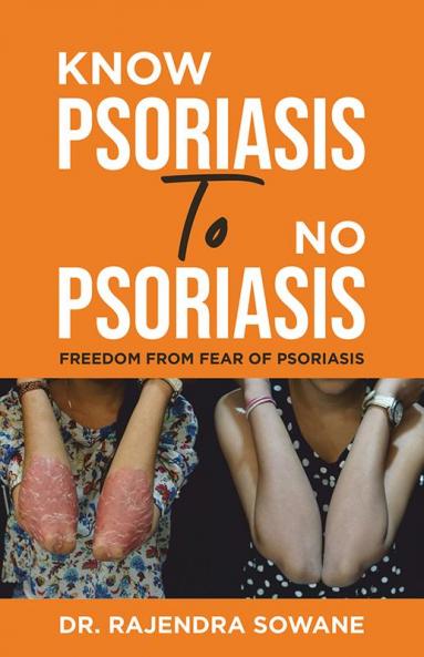 Know Psoriasis To No Psoriasis: Freedom from Fear of Psoriasis
