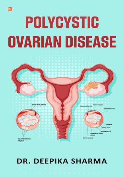 Polycystic Ovarian Disease