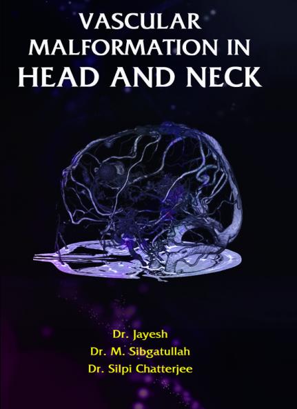 VASCULAR MALFORMATION IN HEAD AND NECK   Volum-1