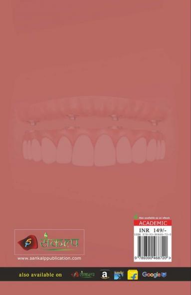 Occlusal Considerations For Implant Supported Prosthesis