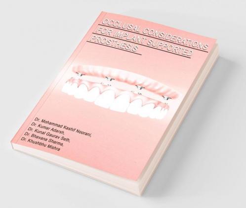 Occlusal Considerations For Implant Supported Prosthesis