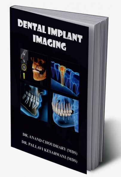 DENTAL IMPLANT IMAGING
