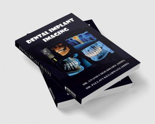 DENTAL IMPLANT IMAGING