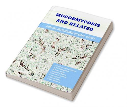 Mucormycosis and Related Fungal Infections of Oral Cavity