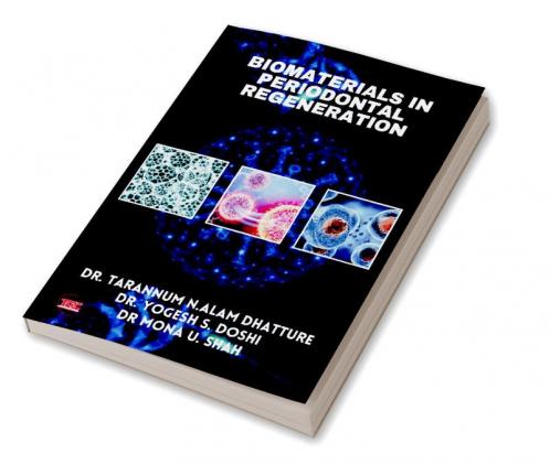 BIOMATERIALS IN PERIODONTAL  REGENERATION