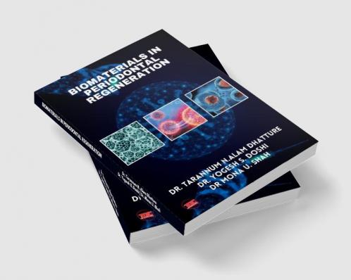 BIOMATERIALS IN PERIODONTAL  REGENERATION