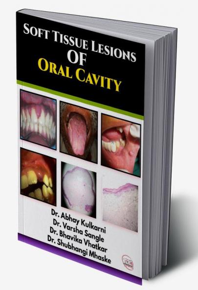 SOFT TISSUE LESIONS OF ORAL CAVITY