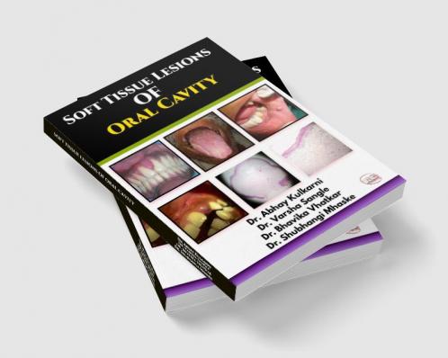 SOFT TISSUE LESIONS OF ORAL CAVITY