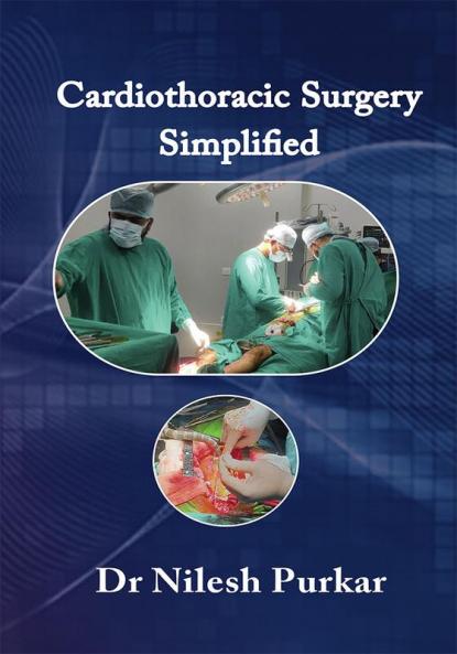Cardiothoracic and Vascular Surgery - Simplified Volume I Volume II Volume III