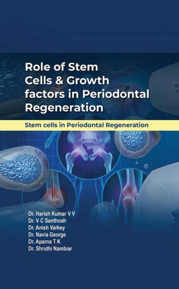 Role of Stem Cells & Growth factors in Periodontal Regeneration