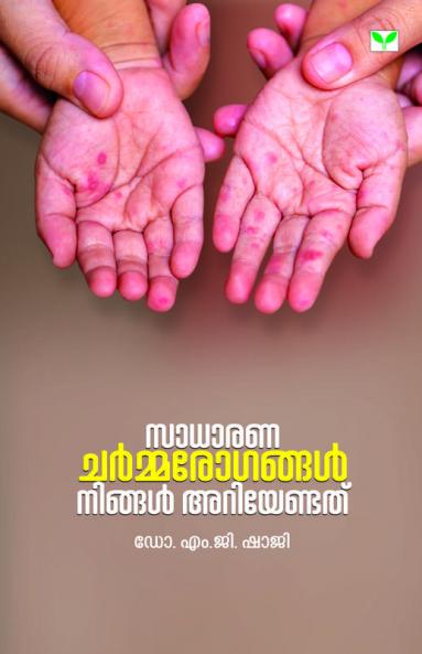 sadharana charmarogangal ningal ariyendathu