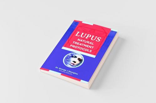 Lupus