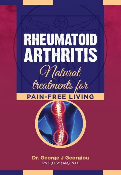 Rheumatoid Arthritis