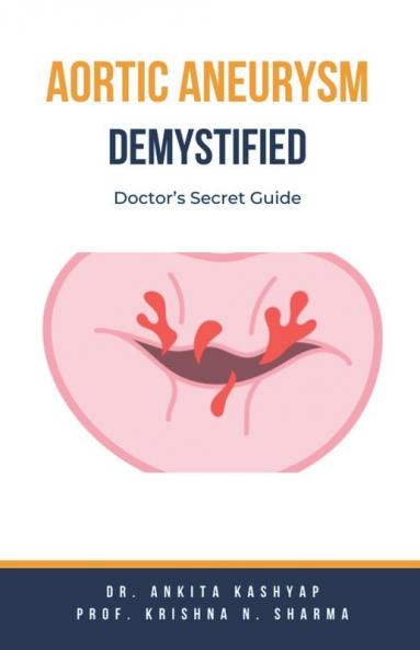 Aortic Aneurysm Demystified