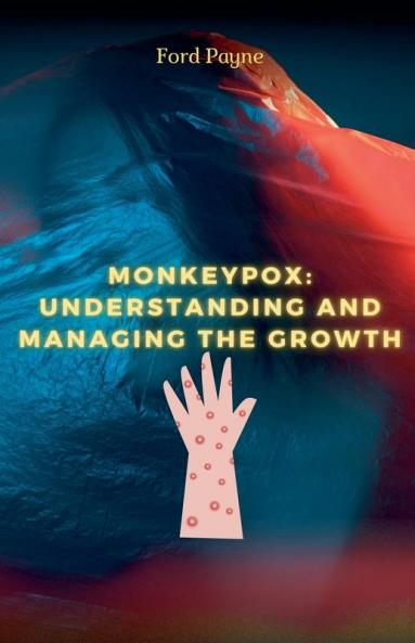 Monkeypox