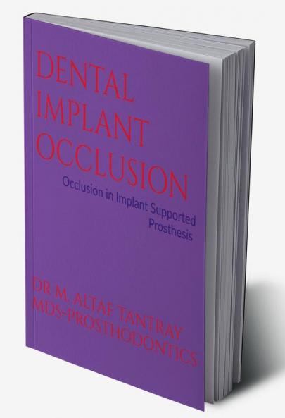 DENTAL IMPLANT OCCLUSION : OCCLUSION IN IMPLANT SUPPORTED PROSTHESIS