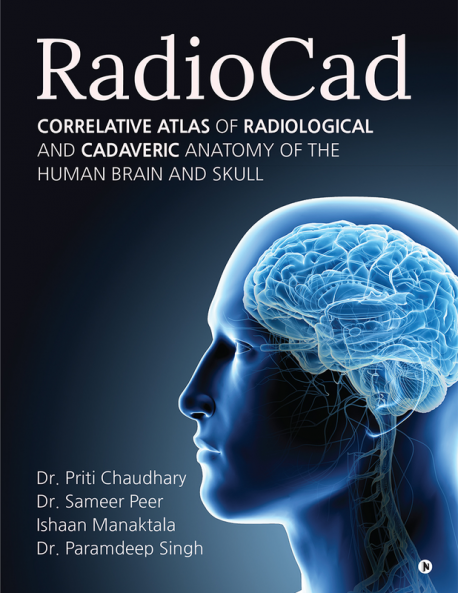 RadioCad : Correlative Atlas of Radiological and Cadaveric Anatomy of the Human Brain and Skull