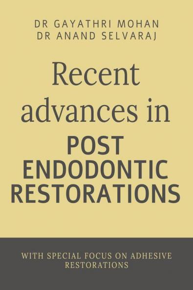 Recent advances in post endodontic restorations