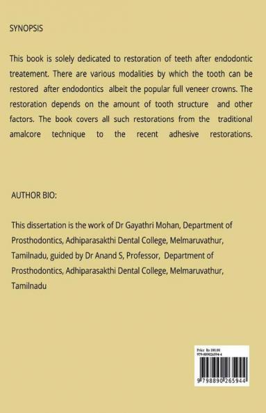 Recent advances in post endodontic restorations
