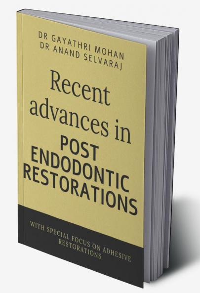 Recent advances in post endodontic restorations