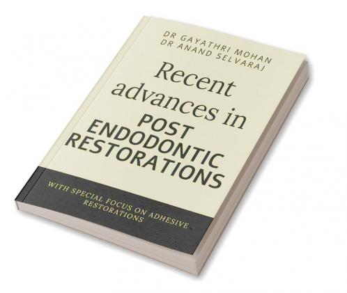 Recent advances in post endodontic restorations