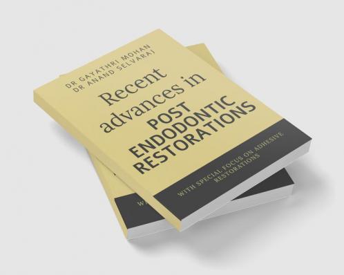 Recent advances in post endodontic restorations