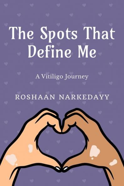 The Spots That Define Me : A Vitiligo Journey