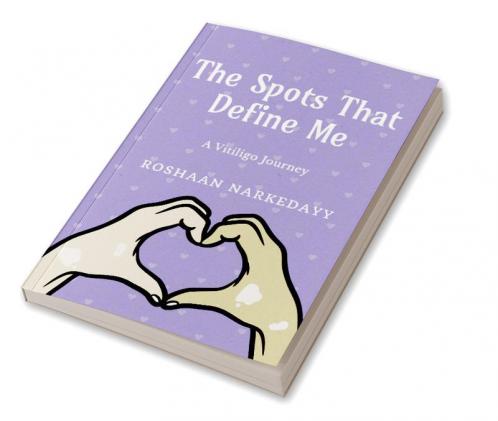 The Spots That Define Me : A Vitiligo Journey