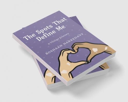 The Spots That Define Me : A Vitiligo Journey