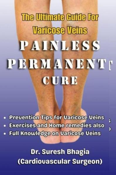 The Ultimate Guide For Varicose Veins : Tips for Prevention Home Remedies and Best Treatment Options
