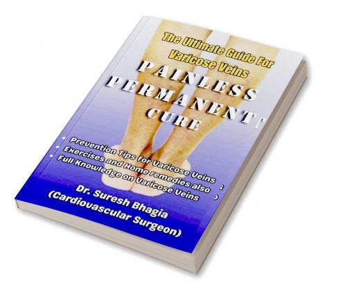 The Ultimate Guide For Varicose Veins : Tips for Prevention Home Remedies and Best Treatment Options