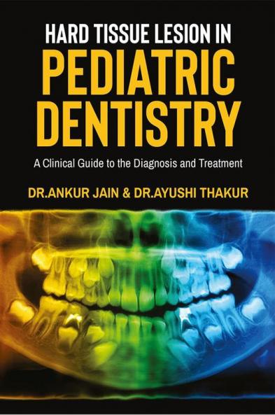 HARD TISSUE LESION IN PEDIATRIC DENTISTRY : &quot;A Clinical Guide to the Diagnosis and  Treatment&quot;