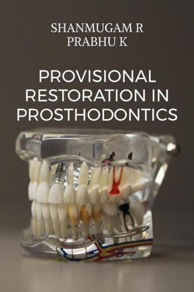 Provisional Restoration in Prosthodontics : a prep guide
