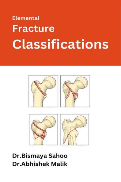 Elemental Fracture Classifications