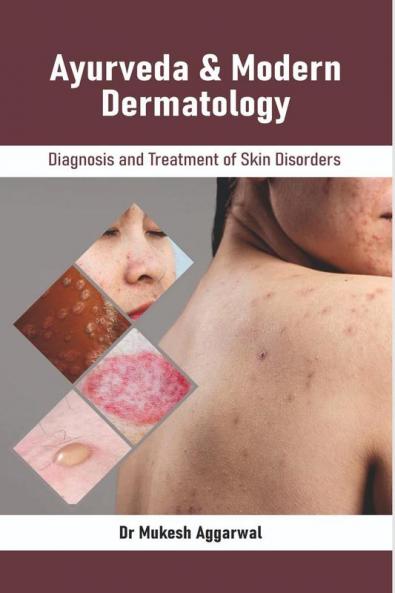 Ayurveda & Modern Dermatology: Diagnosis and Treatment of Skin Disorders
