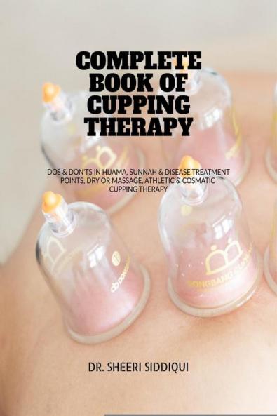 COMPLETE BOOK OF CUPPING THERAPY: DOS & DON'TS IN HIJAMA SUNNAH & DISEASE TREATMENT POINTS DRY OR MASSAGE ATHLETIC & COSMATIC CUPPING THERAPY
